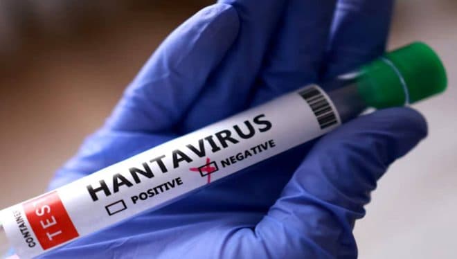 Imagen de la noticia: Academia Nacional de Medicina descarta ‘alerta sanitaria’ por hantavirus en Venezuela